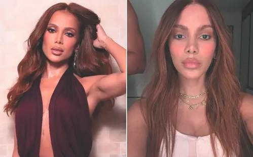 
          Imagem ilustrativa da imagem Médicos explicam mudanças e o novo visual de Anitta
          