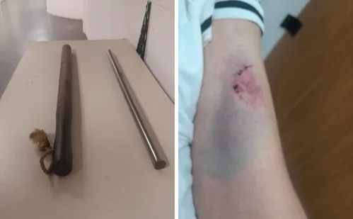 
          Imagem ilustrativa da imagem Músico é agredido com porrete por dono de bar no centro de Vitória
          