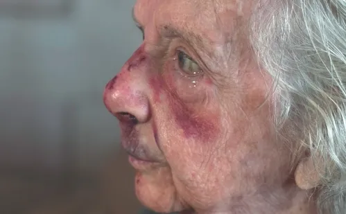 
          Imagem ilustrativa da imagem “Não vou deixar de sair”, diz idosa ferida em roubo no Centro de Vitória
          