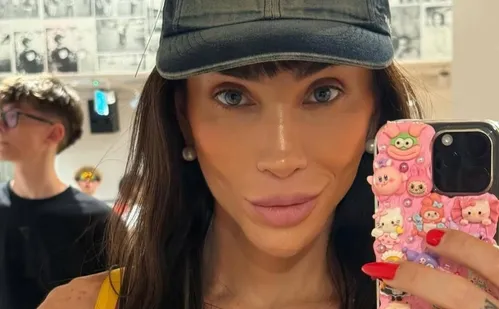 
          Imagem ilustrativa da imagem Riscos no procedimento para mudar a cor dos olhos, como fez Andressa Urach
          