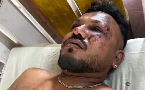 
          Imagem ilustrativa da imagem Sobrevivente de queda de avião na Índia relata o que aconteceu: 'levantei e corri'
          