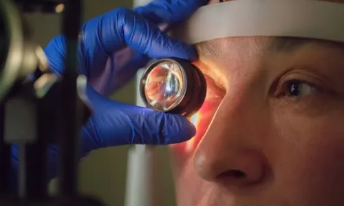 
          Imagem ilustrativa da imagem Você coça muito os olhos? Isso pode causar ceratocone, alerta oftamologista
          