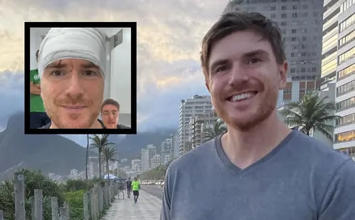 
          Imagem ilustrativa da imagem Jornalista americano elogia SUS após acidente no Rio: 'atendido com dignidade'
          