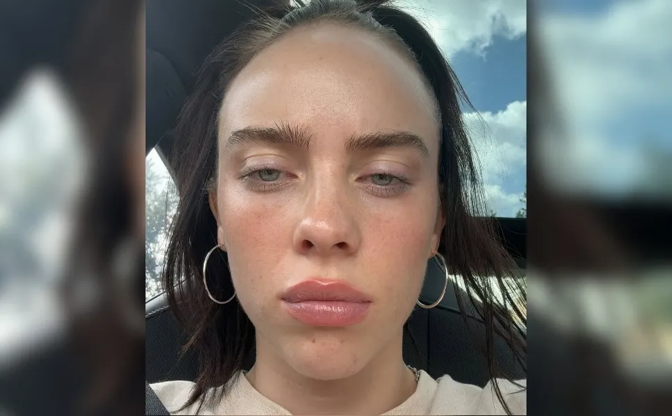 Imagem ilustrativa da imagem 'Muito brancos': fãs criticam Billie Eilish e apontam fala racista em show