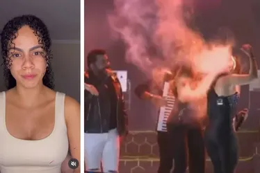 Imagem ilustrativa da imagem Após cabelo pegar fogo em show, Nath Souza se afasta com síndrome do pânico