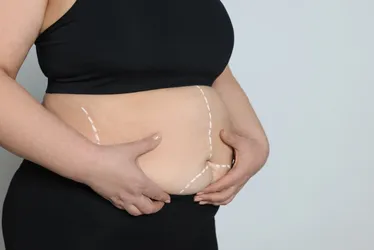 Imagem ilustrativa da imagem Após novas regras, mais jovens buscam por cirurgia bariátrica