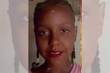 Imagem ilustrativa da imagem Menina de 9 anos morre depois de comer bolo e pão de queijo em MG