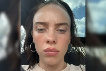 Imagem ilustrativa da imagem 'Muito brancos': fãs criticam Billie Eilish e apontam fala racista em show