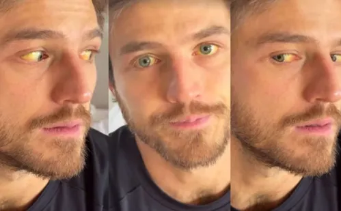 
          Imagem ilustrativa da imagem Após ter hepatite, noivo de Juliette estrela campanha do Ministério da Saúde
          