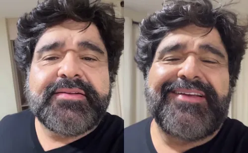 
          Imagem ilustrativa da imagem Fabiano, da dupla com César Menotti, mantém show após sofrer acidente: 'benção'
          