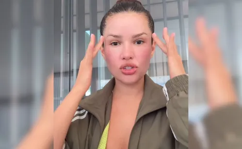 
          Imagem ilustrativa da imagem Juliette mostra como está o rosto após procedimento estético com esperma de salmão
          