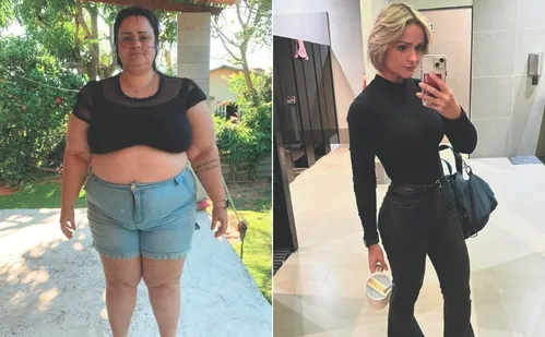 
          Imagem ilustrativa da imagem Três mil pacientes por ano recorrem à cirurgia para perder peso no ES
          