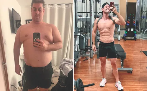 
          Imagem ilustrativa da imagem Três mil pacientes por ano recorrem à cirurgia para perder peso no ES
          