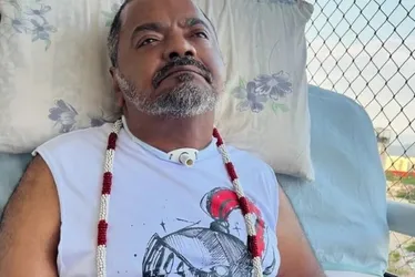 Imagem ilustrativa da imagem Arlindo Cruz, morto aos 66 anos, teve AVC hemorrágico; entenda a doença
