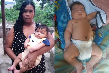 Imagem ilustrativa da imagem “Bebê gigante” de 7 kg nasce de parto normal e mãe leva 51 pontos no ES
