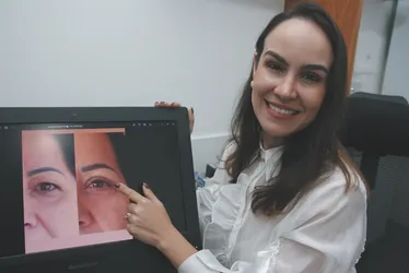 Imagem ilustrativa da imagem Blefaroplastia: conheça a cirurgia que supera a lipo na busca pela beleza