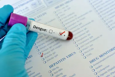 Imagem ilustrativa da imagem Casos de dengue caem pela metade em Pernambuco, mas doença ainda mata