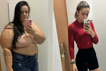 Imagem ilustrativa da imagem Da obesidade ao bem-estar: capixabas relatam mudanças de vida após a bariátrica