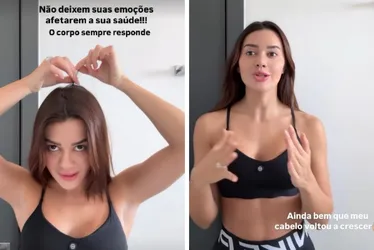 Imagem ilustrativa da imagem Franciny Ehlke revela que perdeu cabelo por estresse e fala sobre alopecia