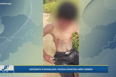 Imagem ilustrativa da imagem Jovem com deficiência é espancado e abandonado em terreno baldio em Garanhuns