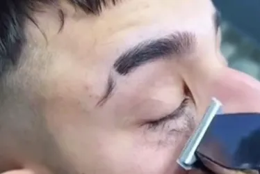 Imagem ilustrativa da imagem Moda de cortar cílios vira risco para a visão, alerta especialista