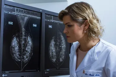 Imagem ilustrativa da imagem Uma em cada três mulheres com câncer de mama em PE tem menos de 50 anos