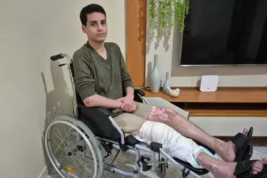Imagem ilustrativa da imagem Vítima de acidente com moto: “Por causa da pressa perdi um ano e meio de minha vida