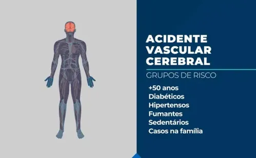 
          Imagem ilustrativa da imagem AVC mata uma pessoa a cada seis minutos no Brasil
          