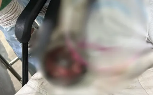 
          Imagem ilustrativa da imagem Açougueiro sofre acidente de trabalho e tem mão triturada por moedor em Colatina
          