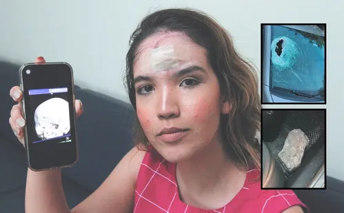 
          Imagem ilustrativa da imagem Advogada que levou pedrada na Rodovia do Sol vai passar por nova cirurgia
          