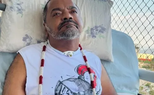 
          Imagem ilustrativa da imagem Arlindo Cruz, morto aos 66 anos, teve AVC hemorrágico; entenda a doença
          