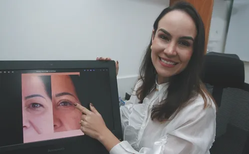 
          Imagem ilustrativa da imagem Blefaroplastia: conheça a cirurgia que supera a lipo na busca pela beleza
          