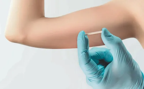 
          Imagem ilustrativa da imagem Boa notícia para mulheres: planos vão ter de cobrir implante contra gravidez
          