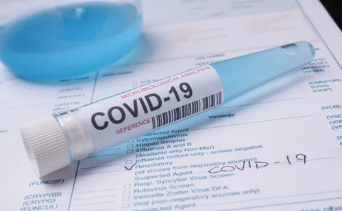 
          Imagem ilustrativa da imagem Covid já matou 37 pessoas no Espírito Santo em 2025
          