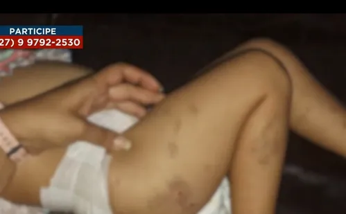 
          Imagem ilustrativa da imagem Criança de dois anos sofre múltiplos ferimentos após ataque de cães em Vitória
          