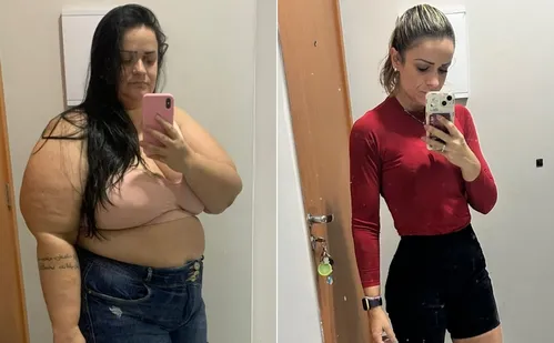 
          Imagem ilustrativa da imagem Da obesidade ao bem-estar: capixabas relatam mudanças de vida após a bariátrica
          