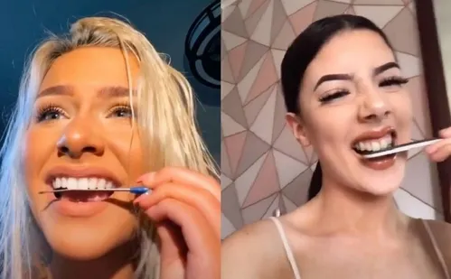 
          Imagem ilustrativa da imagem Especialistas alertam para moda perigosa que pode levar à perda de dentes
          