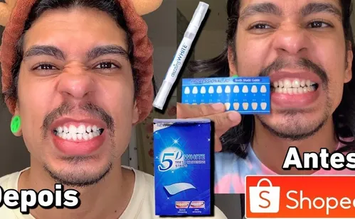 
          Imagem ilustrativa da imagem Especialistas alertam para moda perigosa que pode levar à perda de dentes
          