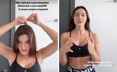 
          Imagem ilustrativa da imagem Franciny Ehlke revela que perdeu cabelo por estresse e fala sobre alopecia
          