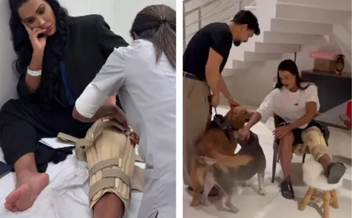 
          Imagem ilustrativa da imagem Gracyanne Barbosa compartilha detalhes de lesão no joelho após acidente
          