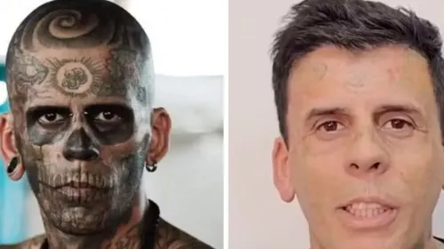 
          Imagem ilustrativa da imagem Homem mais tatuado do Brasil está irreconhecível após remoção de tatuagens
          