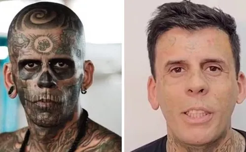 
          Imagem ilustrativa da imagem Mais tatuado do Brasil aparece irreconhecível após remoção de tatuagens
          