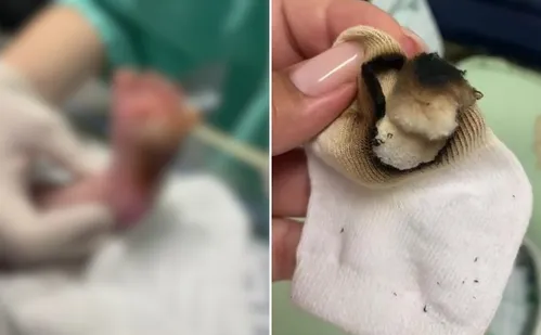 
          Imagem ilustrativa da imagem Queimadura em bebê foi erro individual, diz auditoria
          