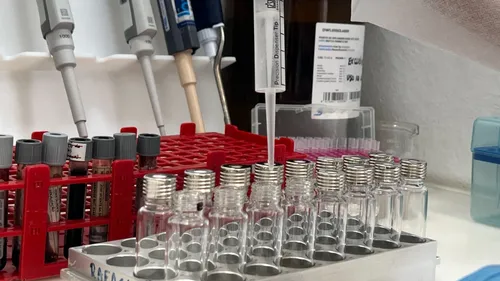 
          Imagem ilustrativa da imagem Saiba como a Polícia Cientifica trabalha para identificar casos de intoxicação
          