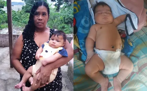 
          Imagem ilustrativa da imagem Secretaria de Saúde instaura auditoria para investigar parto de bebê de 7kg no ES
          