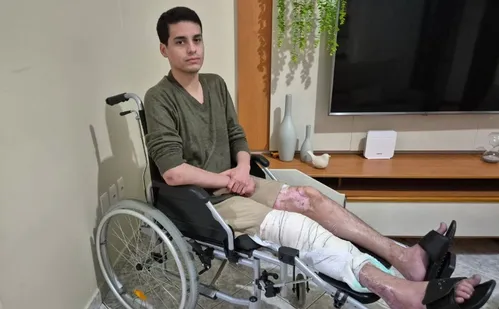 
          Imagem ilustrativa da imagem Vítima de acidente com moto: “Por causa da pressa perdi um ano e meio de minha vida
          