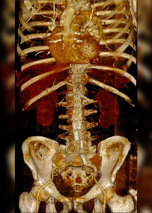 Imagem ilustrativa da imagem Médicos debatem IA e medicina regenerativa
