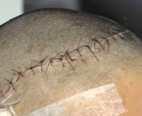 Imagem ilustrativa da imagem Adolescente sofre golpe em aula experimental de kickboxing e acaba internado na UTI