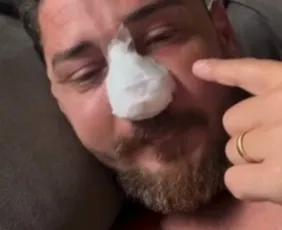 Imagem ilustrativa da imagem Barraca onde casal de turistas foi agredido em Porto de Galinhas é multada em R$ 12 mil pelo Procon