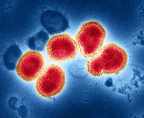 Imagem ilustrativa da imagem México confirma 1º caso da 'supergripe' H3N2 que se espalhou pela Europa e EUA